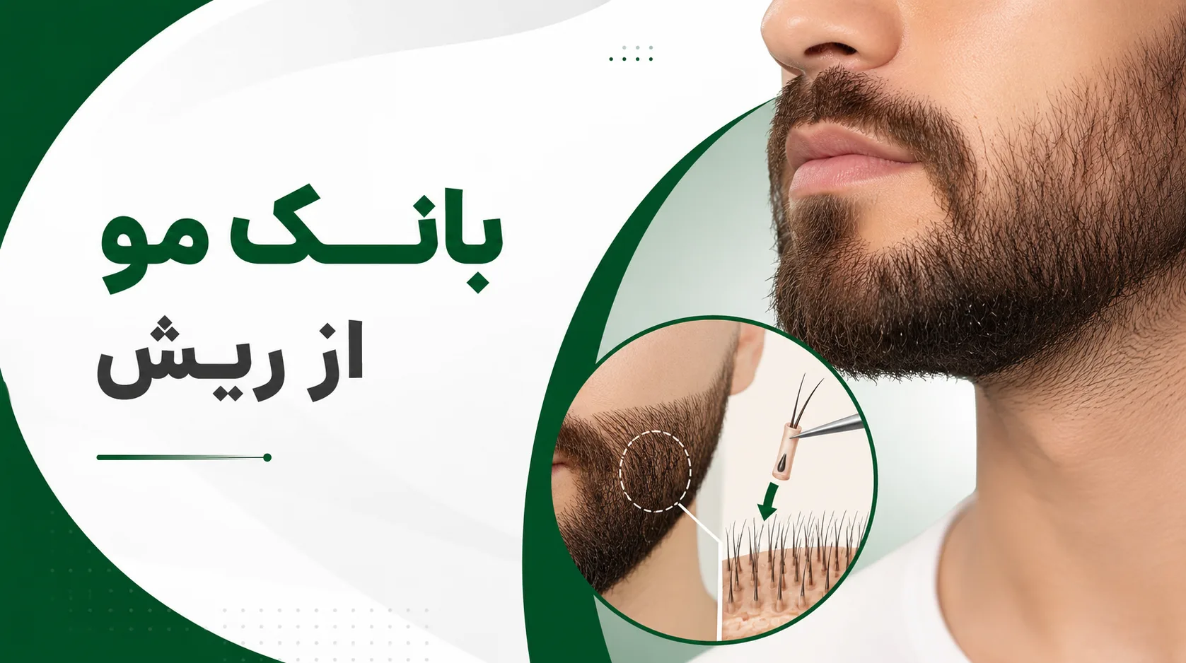 بانک مو از ریش